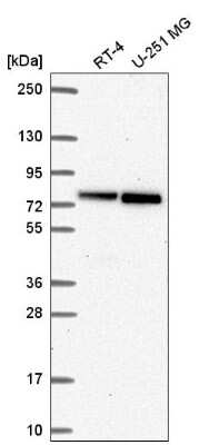 Western Blot: RECQ1 Antibody [NBP2-57572]