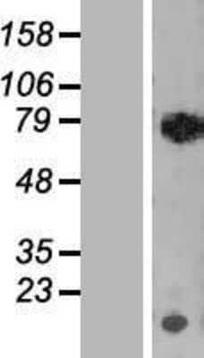 Western Blot: RECQ1 Overexpression Lysate [NBL1-15264]