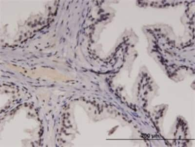 Immunohistochemistry-Paraffin: RECQL4 Antibody (2G8) [H00009401-M09]