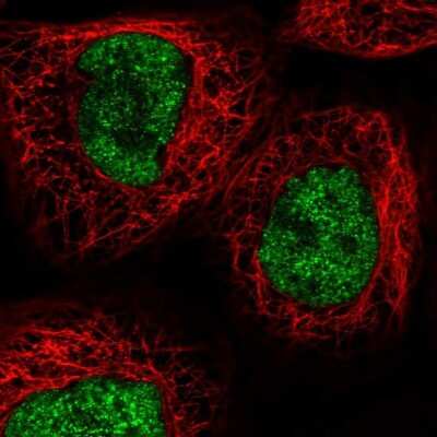 Immunocytochemistry/ Immunofluorescence: RECQL4 Antibody [NBP2-47310]