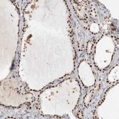 Immunohistochemistry-Paraffin: RECQL4 Antibody [NBP2-47310]