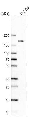 Western Blot: RECQL4 Antibody [NBP2-47310]