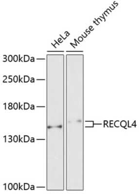 Western Blot: RECQL4 AntibodyAzide and BSA Free [NBP2-95219]