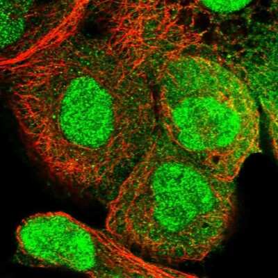 Immunocytochemistry/ Immunofluorescence: RECQL5 Antibody [NBP1-83438]