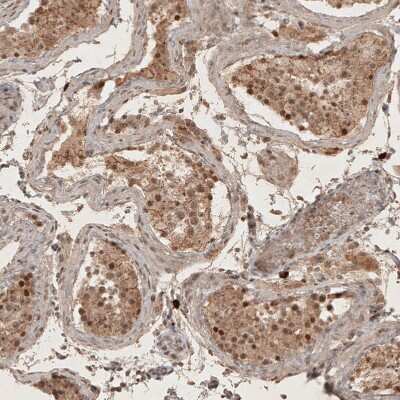 Immunohistochemistry-Paraffin: RECQL5 Antibody [NBP1-83438]