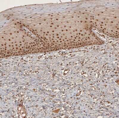 Immunohistochemistry-Paraffin: RECQL5 Antibody [NBP1-83438]