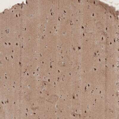 Immunohistochemistry-Paraffin: RECQL5 Antibody [NBP1-83438]