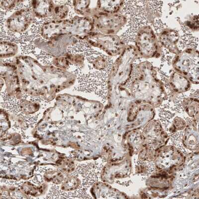 Immunohistochemistry-Paraffin: RECQL5 Antibody [NBP1-83438]