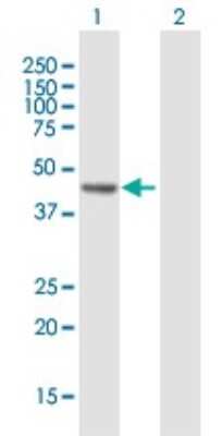 Western Blot: RECQL5 Antibody [H00009400-B01P]