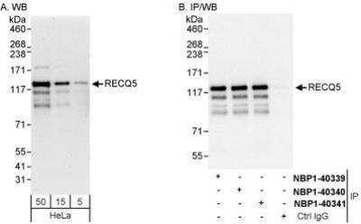 Western Blot: RECQL5 Antibody [NBP1-40341]