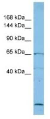 Western Blot: RECQL5 Antibody [NBP3-10393]