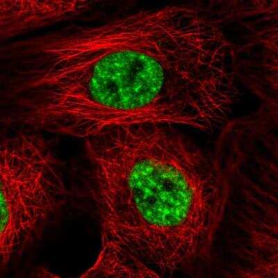 Immunocytochemistry/ Immunofluorescence: RED Antibody [NBP2-38591]