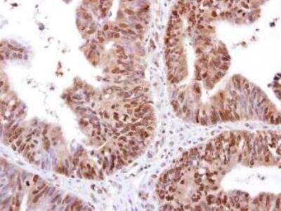 Immunohistochemistry-Paraffin: RED Antibody [NBP1-30927]