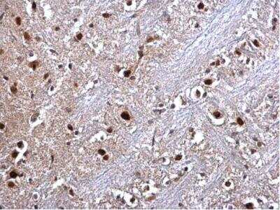 Immunohistochemistry-Paraffin: RED Antibody [NBP2-20119]