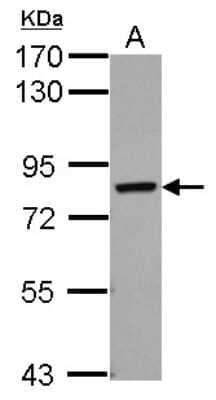 Western Blot: RED Antibody [NBP2-20119]