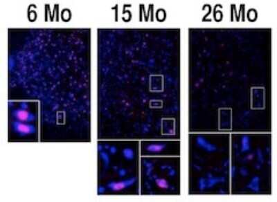 Immunocytochemistry/ Immunofluorescence: RED1 Antibody [NBP3-11887]