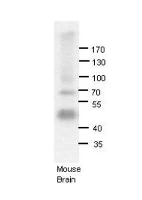 Western Blot: RED1 Antibody [NBP2-86772]