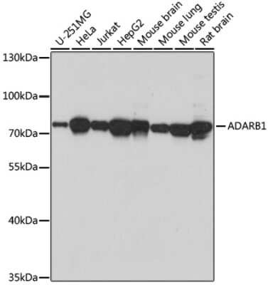 Western Blot: RED1 AntibodyAzide and BSA Free [NBP2-94794]