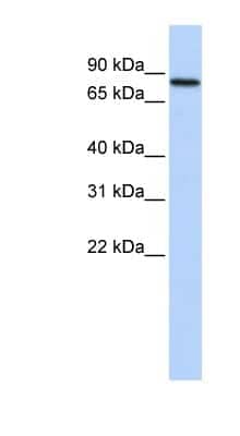 Western Blot: RED2 Antibody [NBP1-57558]