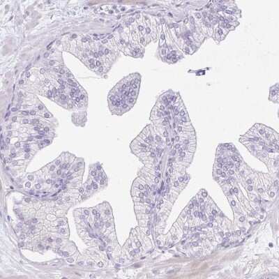 Immunohistochemistry-Paraffin: REEP1 Antibody [NBP2-34095]