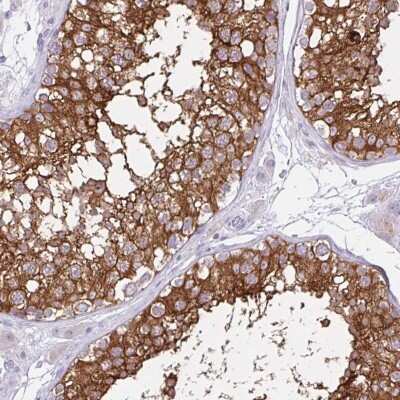 Immunohistochemistry-Paraffin: REEP1 Antibody [NBP2-34095]