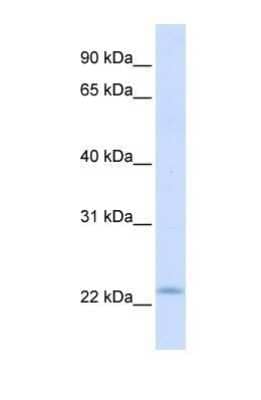 Western Blot: REEP1 Antibody [NBP1-69643]