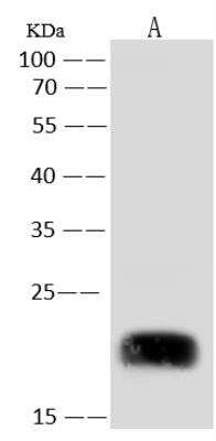 Western Blot: REEP1 Antibody [NBP3-14647]