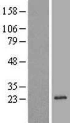 Western Blot: REEP1 Overexpression Lysate [NBL1-15266]