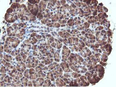 Immunohistochemistry-Paraffin: REEP2 Antibody (OTI2C7) [NBP2-01796]