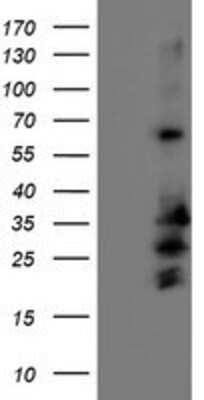 Western Blot: REEP2 Antibody (OTI2C7) [NBP2-01796]