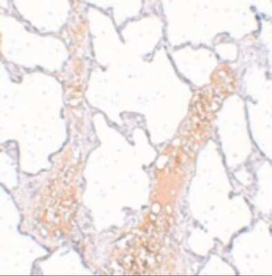 Immunohistochemistry: REEP2 Antibody - BSA Free [NBP1-77104]