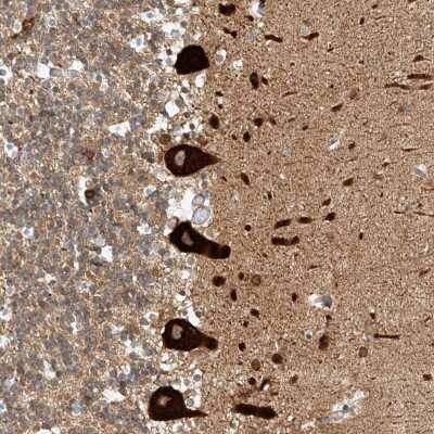 Immunohistochemistry: REEP2 Antibody [NBP2-32017]
