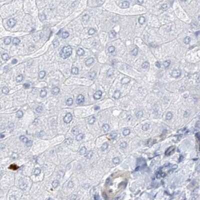 Immunohistochemistry: REEP2 Antibody [NBP2-32017]