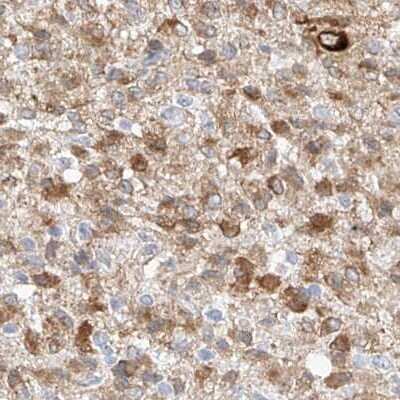 Immunohistochemistry: REEP2 Antibody [NBP2-32017]