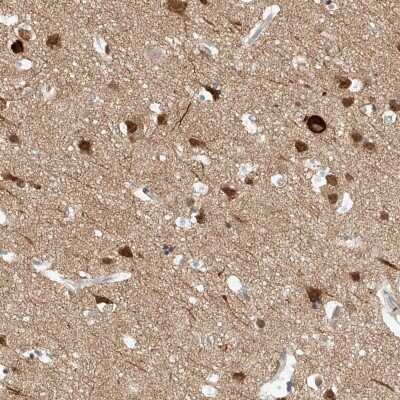Immunohistochemistry-Paraffin: REEP2 Antibody [NBP2-32017]