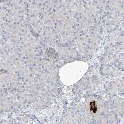 Immunohistochemistry-Paraffin: REEP2 Antibody [NBP2-32017]