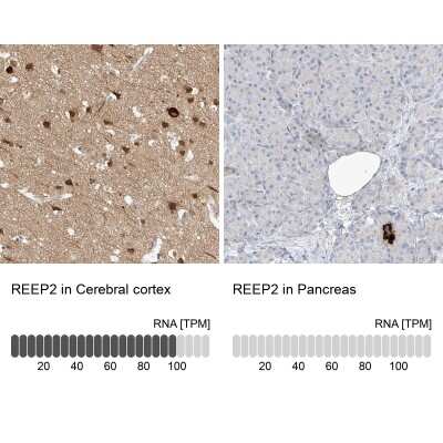 Immunohistochemistry-Paraffin: REEP2 Antibody [NBP2-32017]