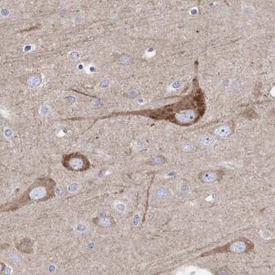 Immunohistochemistry-Paraffin: REEP2 Antibody [NBP3-17757]