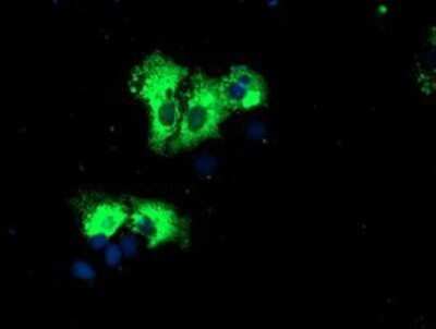 Immunocytochemistry/ Immunofluorescence: REEP2 Antibody (OTI2C7) - Azide and BSA Free [NBP2-73849]