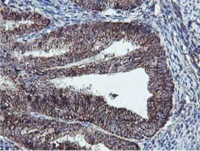 Immunohistochemistry: REEP2 Antibody (OTI2C7) - Azide and BSA Free [NBP2-73849]