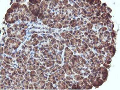 Immunohistochemistry: REEP2 Antibody (OTI2C7) - Azide and BSA Free [NBP2-73849]
