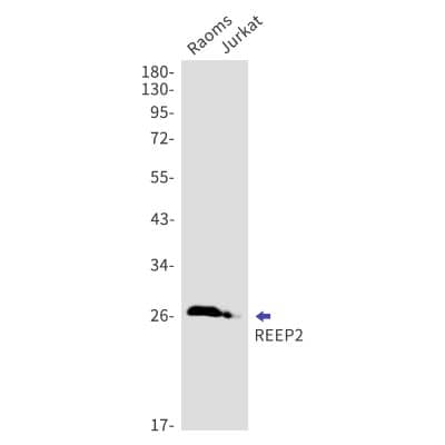 Western Blot: REEP2 Antibody (S07-6C8) [NBP3-19760]