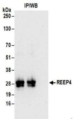 Immunoprecipitation: REEP4 Antibody [NBP2-30361]