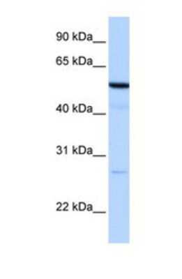 Western Blot: REEP4 Antibody [NBP1-69521]