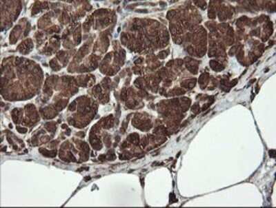 Immunohistochemistry: REEP5 Antibody (OTI4D2) [NBP2-45945]