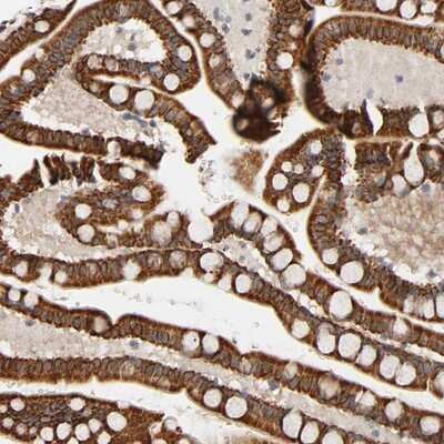 Immunohistochemistry-Paraffin: REEP5 Antibody [NBP1-86775]