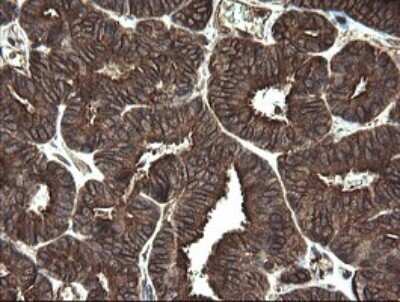 Immunohistochemistry: REEP5 Antibody (OTI4D2) - Azide and BSA Free [NBP2-73850]