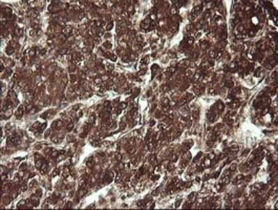 Immunohistochemistry: REEP5 Antibody (OTI4D2) - Azide and BSA Free [NBP2-73850]