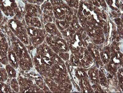 Immunohistochemistry: REEP5 Antibody (OTI4D2) - Azide and BSA Free [NBP2-73850]