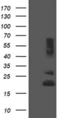 Western Blot: REEP5 Antibody (OTI4D2)Azide and BSA Free [NBP2-73850]